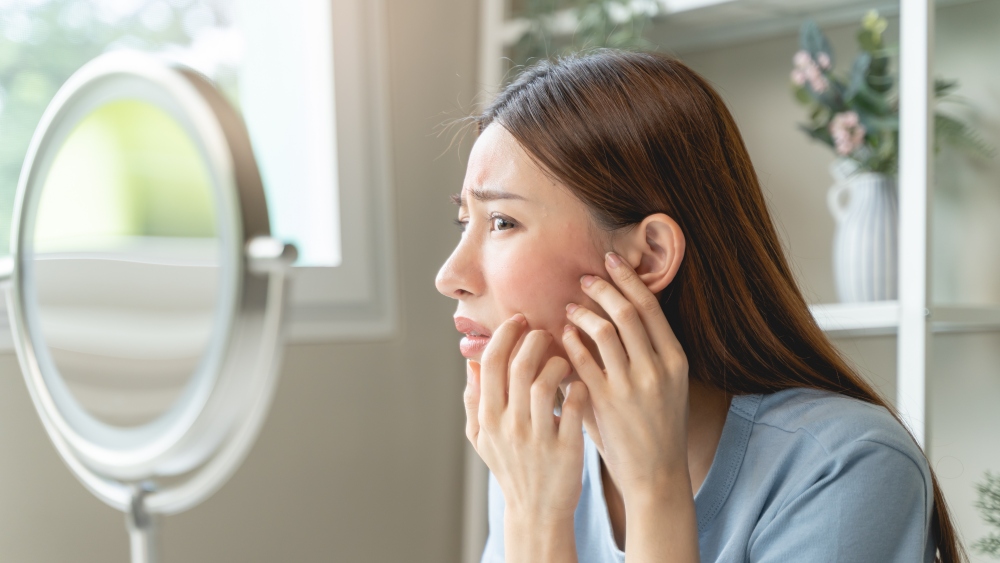 ニキビのレーザー治療「ブルージェネシス」とは？｜ニキビの炎症改善・新たなニキビの予防効果を解説