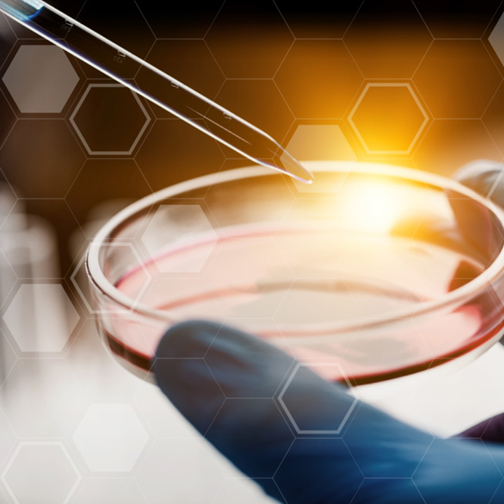 ◆ ステムサップ