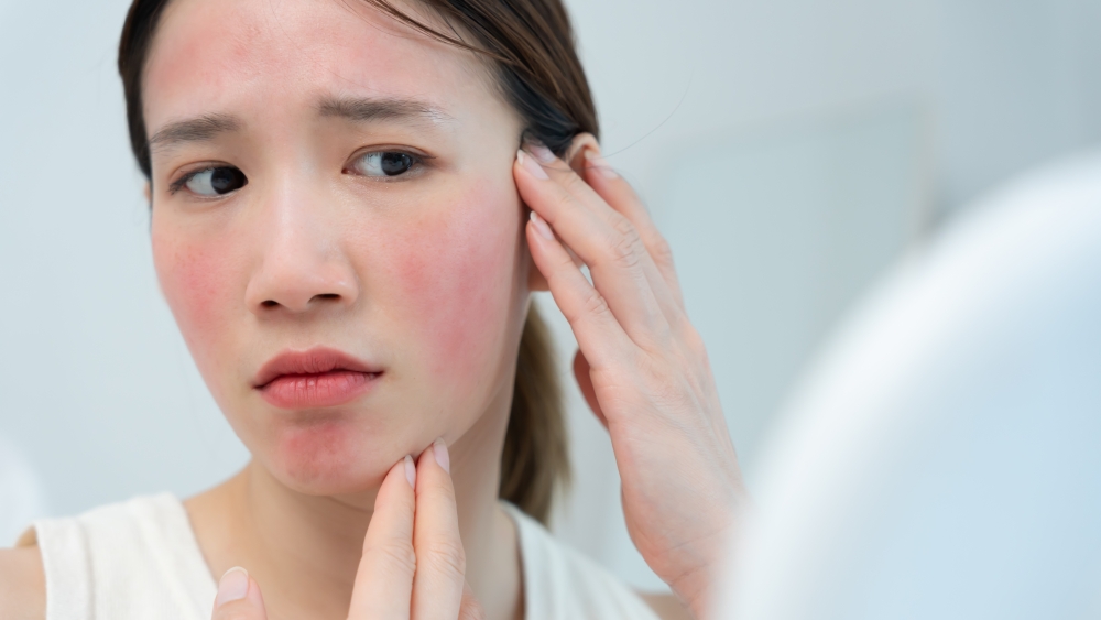 赤ら顔・酒さの違いとは？｜赤ら顔へのブルーレーザー(ブルージェネシス)の効果と特徴